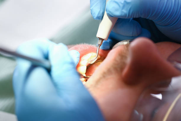 Best Emergency Treatment for Oral Infections in Frederick, MD